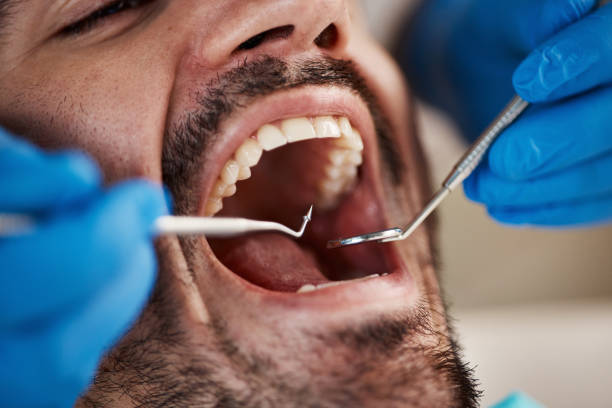 Best Emergency Dental Care for Broken or Chipped Teeth in Cherokee Village, AR